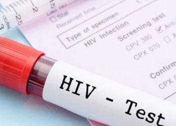 HIV-6337c7ac